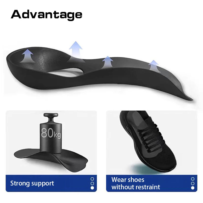 1Pair Flat foot O-shaped leg insoles (for shoes) Corrective arch