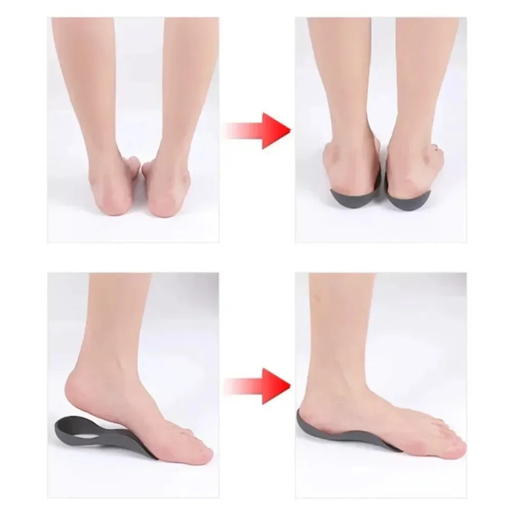 1 Pair Orthotic Insoles For Flat Feet O-Shaped Legs And Plantar