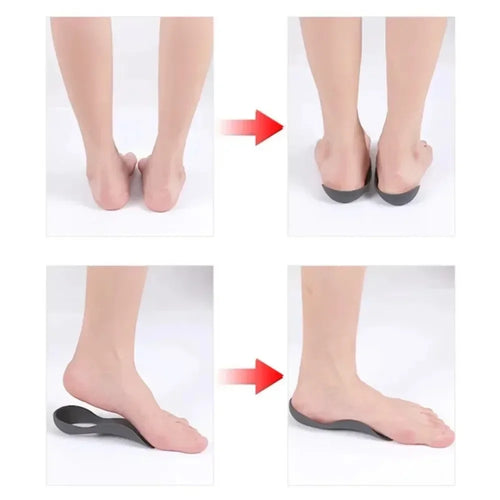 1 Pair Orthotic Insoles For Flat Feet O-Shaped Legs And Plantar