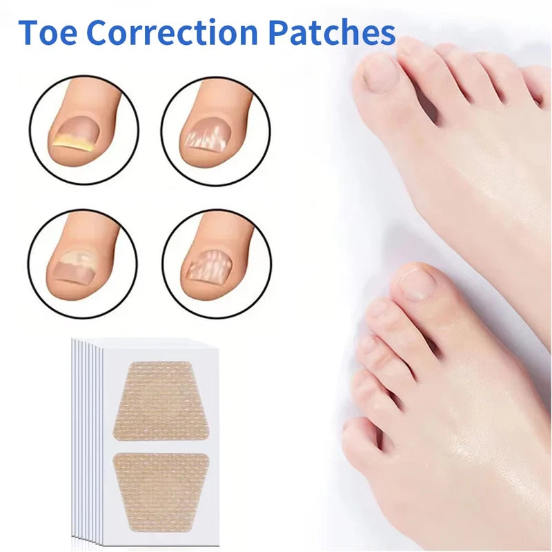Toenail Fungus Patch Nail Repair Patches Nail Ingrown Correction