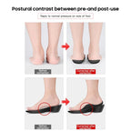 1Pair Flat foot O-shaped leg insoles (for shoes) Corrective arch